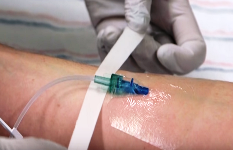 Intravenous Chemotherapy Treatment - zeepedia.com