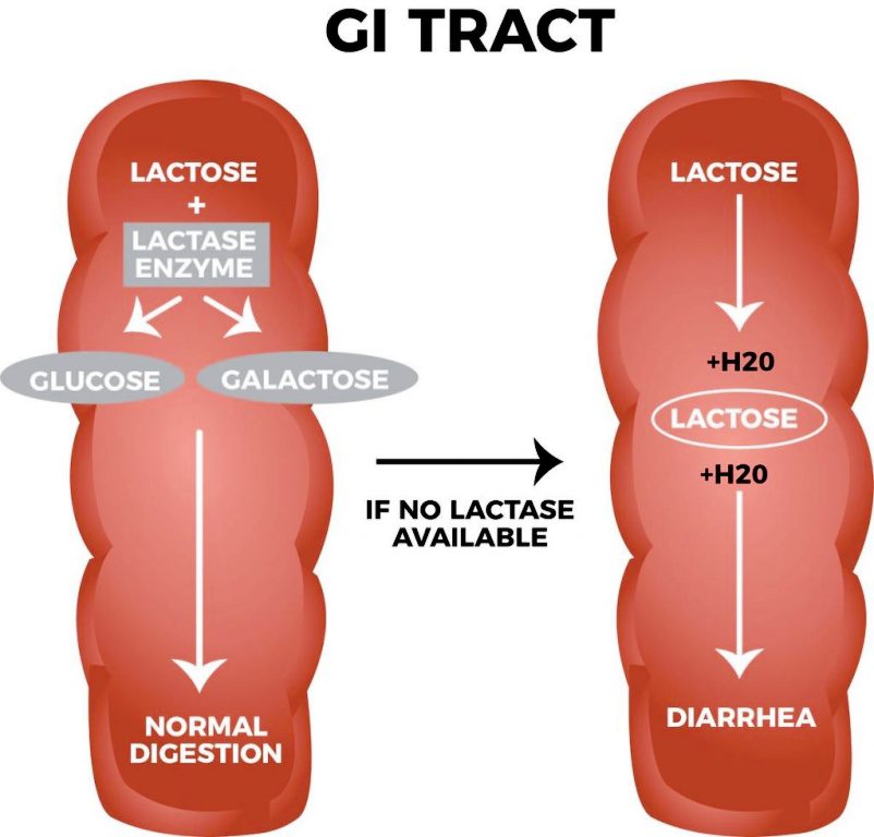 lactose-intolerance-zeepedia