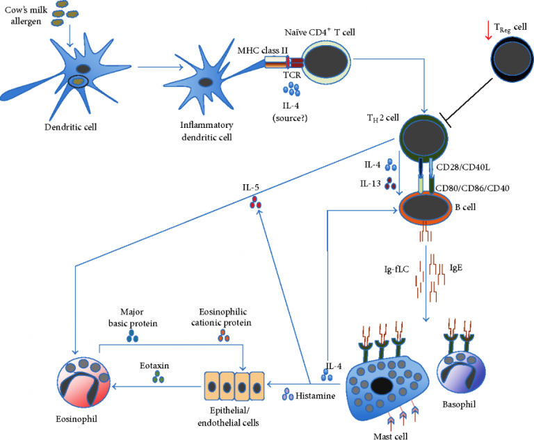 Cow's milk allergy - zeepedia.com