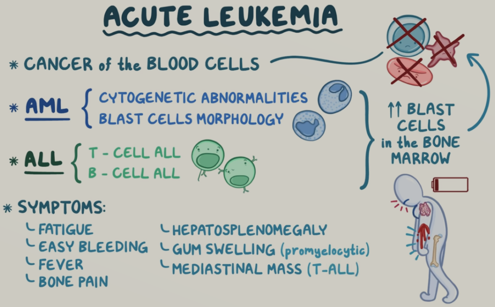 Chemotherapy for Leukemia - zeepedia.com