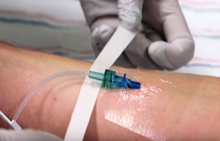 Intravenous Chemotherapy Treatment